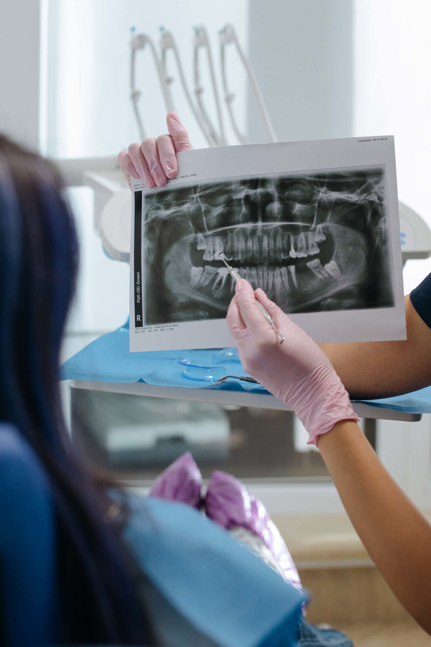 A dentist holds up an Invisalign patient’s X-rays showing crooked teeth.